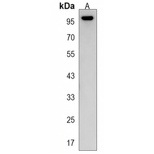 MYLK3 Rabbit Polyclonal Antibody