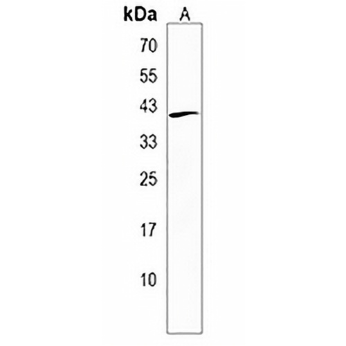VASH2 Rabbit Polyclonal Antibody