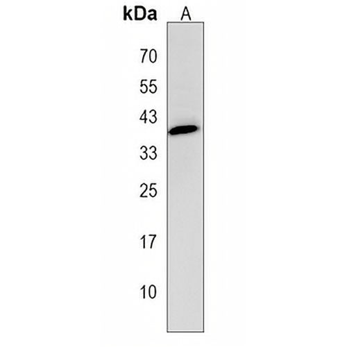 GDPD3 Rabbit Polyclonal Antibody
