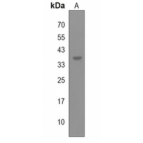 DPAGT1 Rabbit Polyclonal Antibody