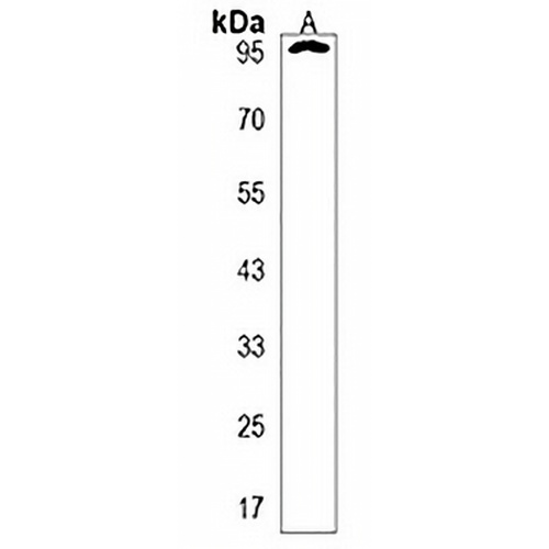 ANKS6 Rabbit Polyclonal Antibody