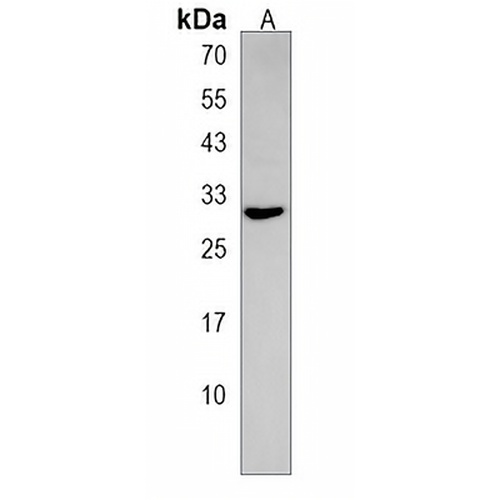 CELA2A Rabbit Polyclonal Antibody