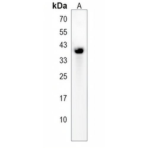 OAF Rabbit Polyclonal Antibody