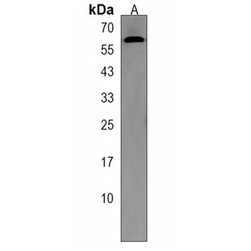 KIAA0895 Rabbit Polyclonal Antibody