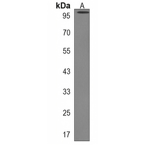 TMC6 Rabbit Polyclonal Antibody