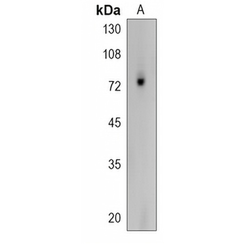PDIA4 Rabbit Polyclonal Antibody