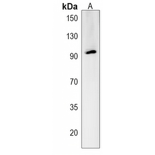 RGS9 Rabbit Polyclonal Antibody
