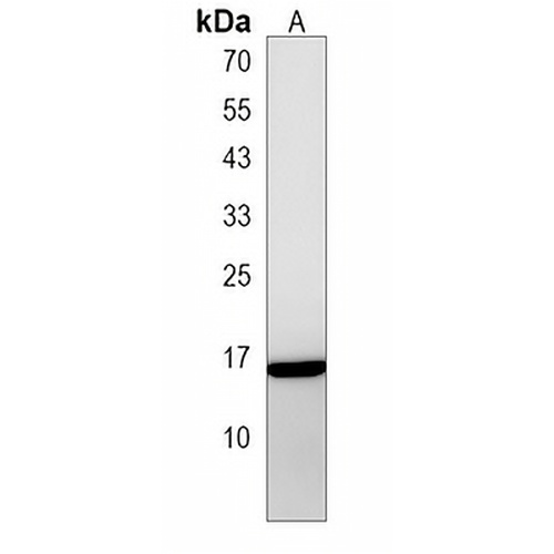 TM4SF18 Rabbit Polyclonal Antibody