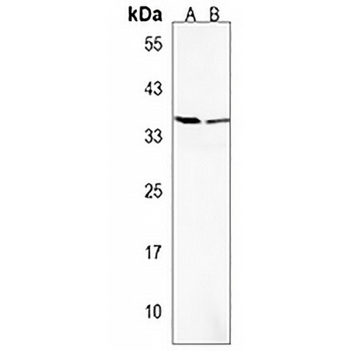 OR52H1 Rabbit Polyclonal Antibody