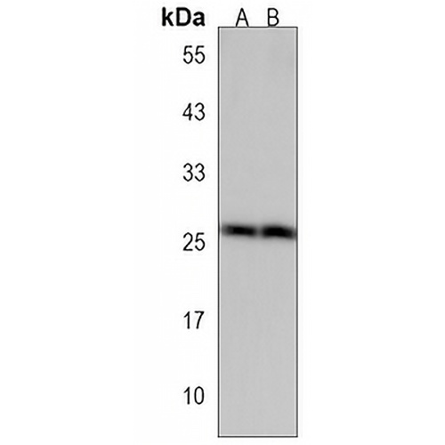 FRAT1 Rabbit Polyclonal Antibody