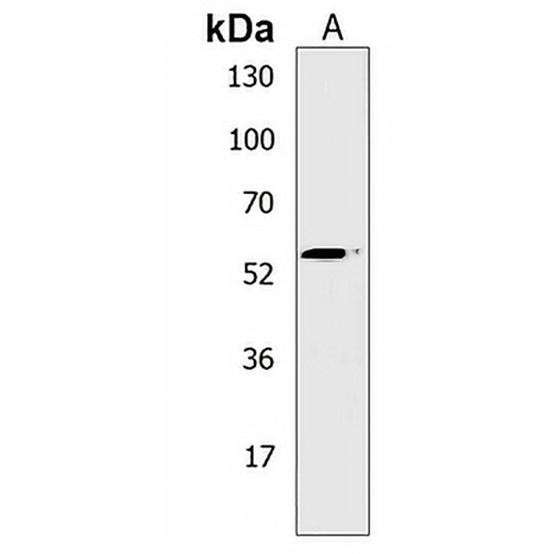 PRAK Rabbit Polyclonal Antibody