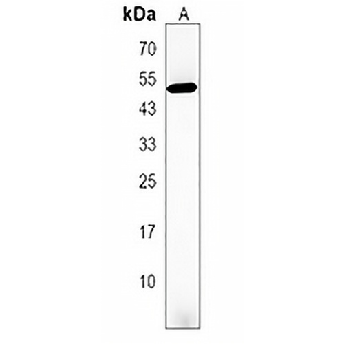HOXD3 Rabbit Polyclonal Antibody