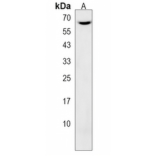 CNOT4 Rabbit Polyclonal Antibody