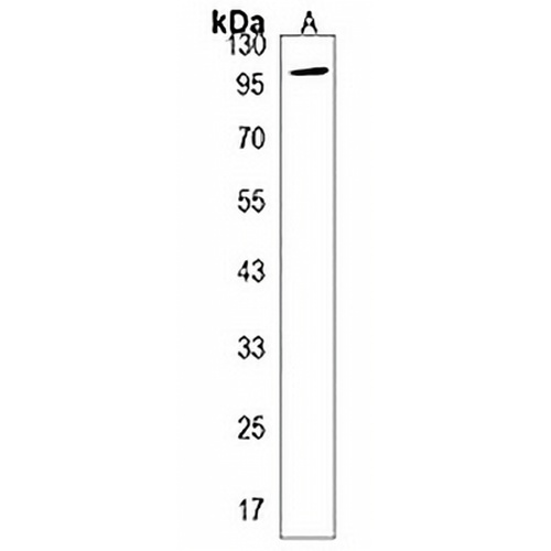 Phospholipase D2 Rabbit Polyclonal Antibody