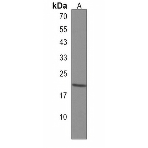 EMC4 Rabbit Polyclonal Antibody