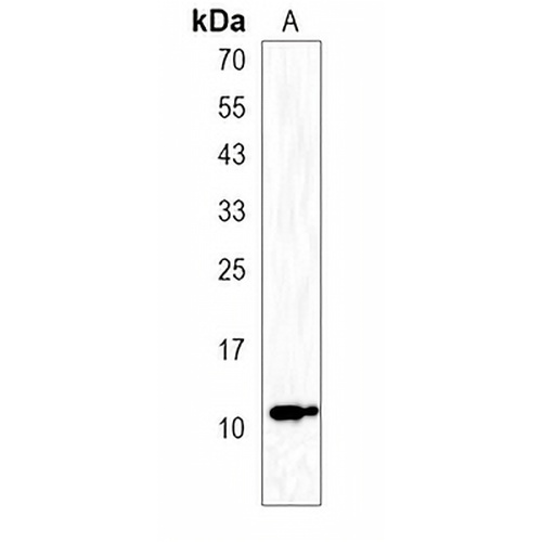 ACBD7 Rabbit Polyclonal Antibody