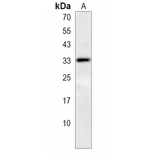 NTAL Rabbit Polyclonal Antibody