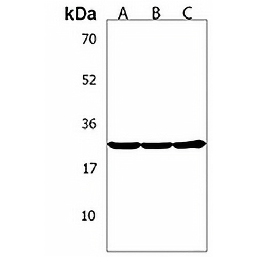 TGIF2 Rabbit Polyclonal Antibody