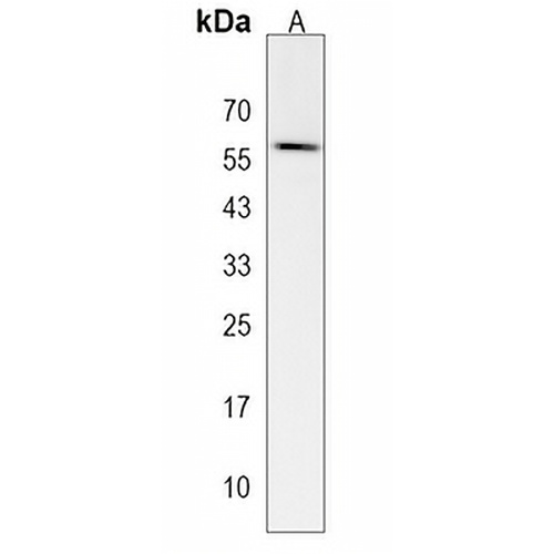 SLC45A3 Rabbit Polyclonal Antibody