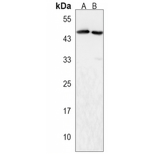 ZDHHC6 Rabbit Polyclonal Antibody