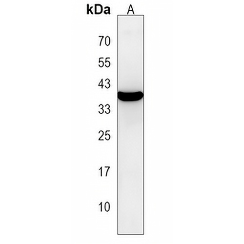 mPR beta Rabbit Polyclonal Antibody