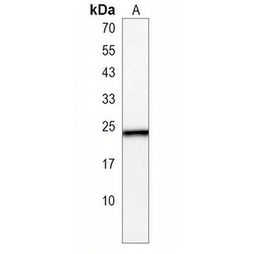 HPCA Rabbit Polyclonal Antibody