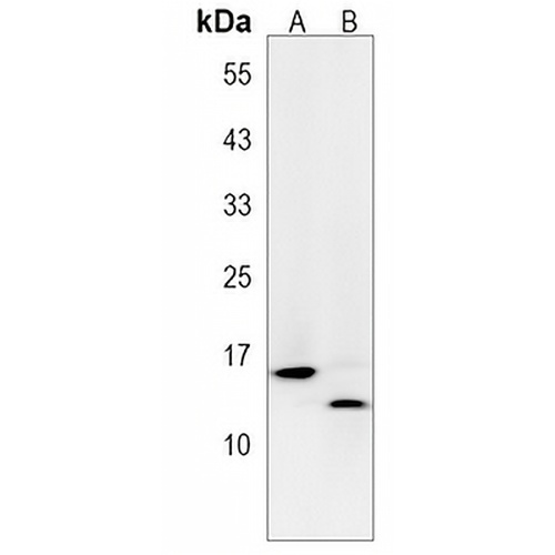 FAU Rabbit Polyclonal Antibody