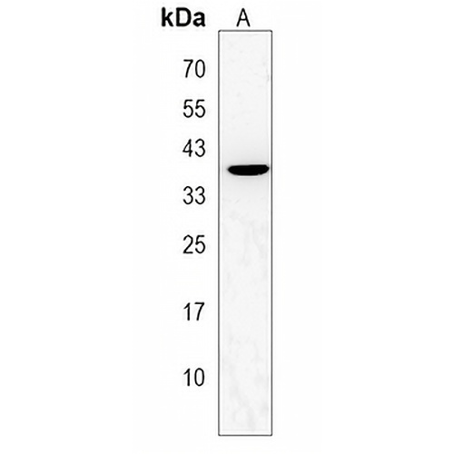 P2Y6 Rabbit Polyclonal Antibody