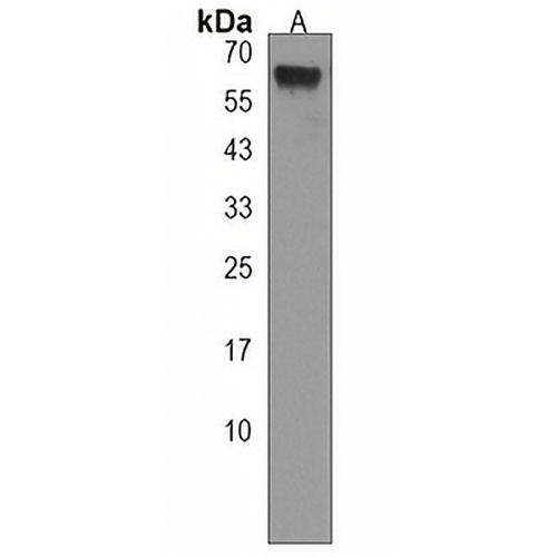 VPS45 Rabbit Polyclonal Antibody