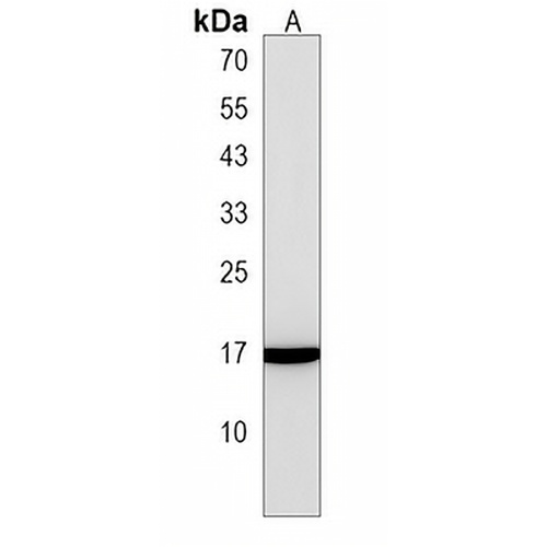 UBALD2 Rabbit Polyclonal Antibody