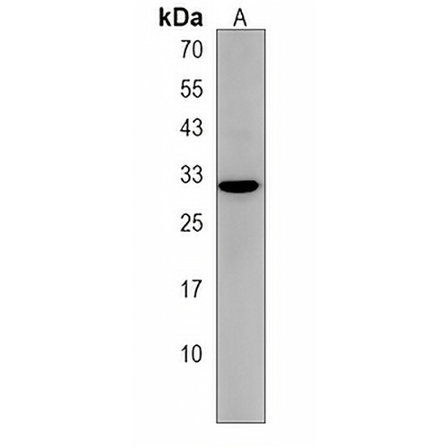 ZDHHC3 Rabbit Polyclonal Antibody