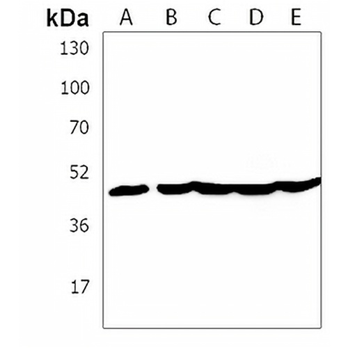 KRT28 Rabbit Polyclonal Antibody