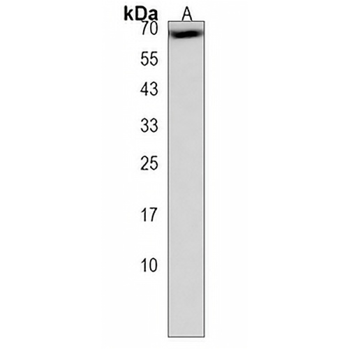 CLPTM1L Rabbit Polyclonal Antibody
