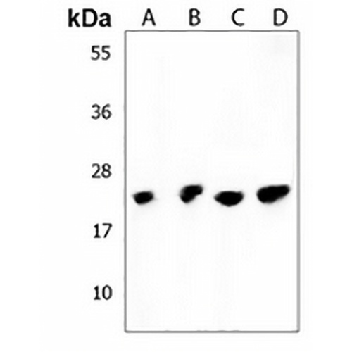 CD84-H1 Rabbit Polyclonal Antibody