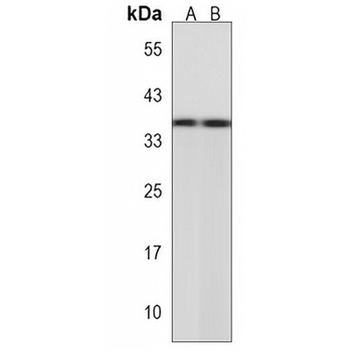 BOLL Rabbit Polyclonal Antibody