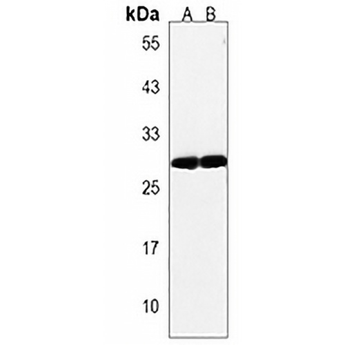 OR4F17 Rabbit Polyclonal Antibody