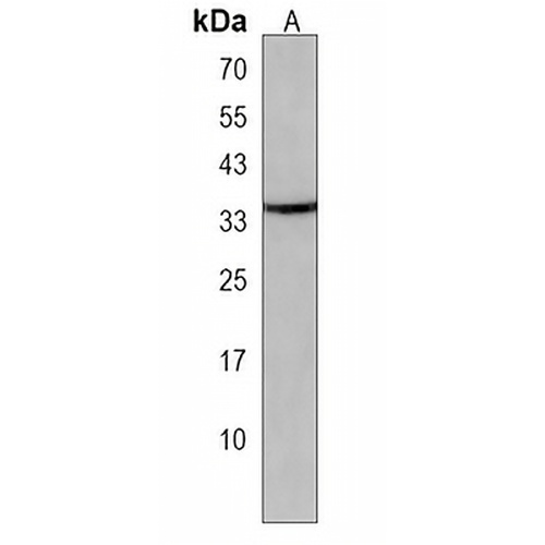 OR4D11 Rabbit Polyclonal Antibody