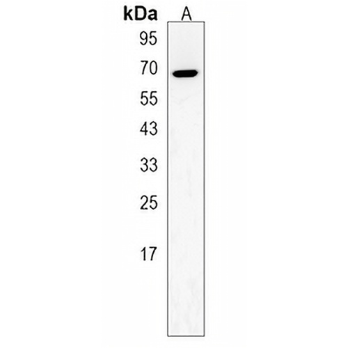 ZNF90 Rabbit Polyclonal Antibody