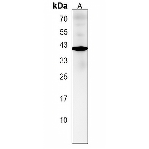 ZNF843 Rabbit Polyclonal Antibody