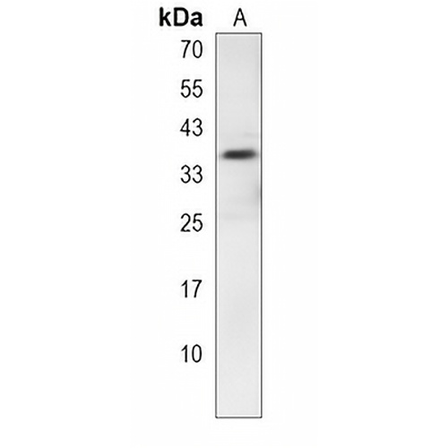 SNAPC2 Rabbit Polyclonal Antibody