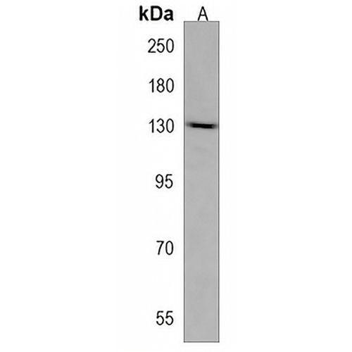 PDS5A Rabbit Polyclonal Antibody
