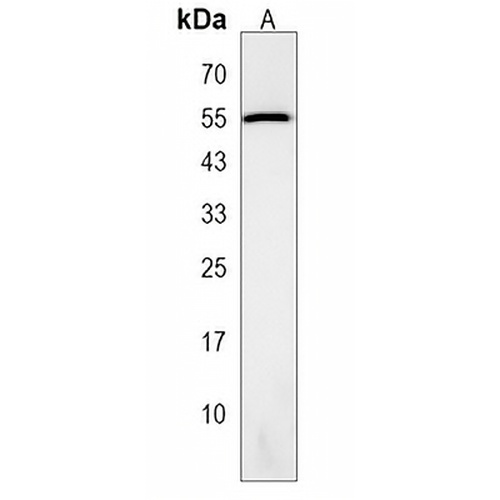 GALR3 Rabbit Polyclonal Antibody