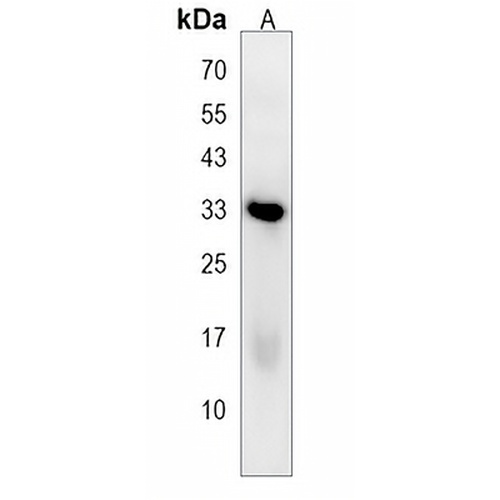 PLEKHF1 Rabbit Polyclonal Antibody