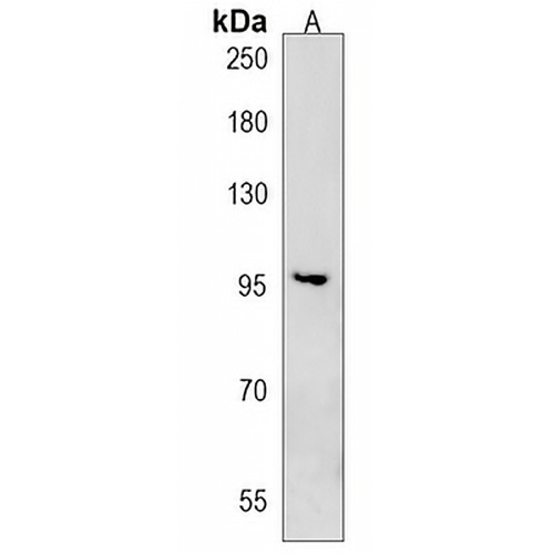 CCDC141 Rabbit Polyclonal Antibody