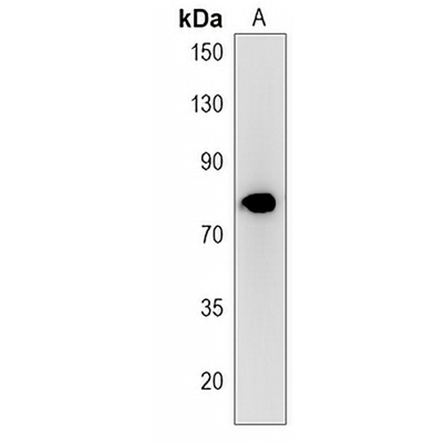 MPP5 Rabbit Polyclonal Antibody