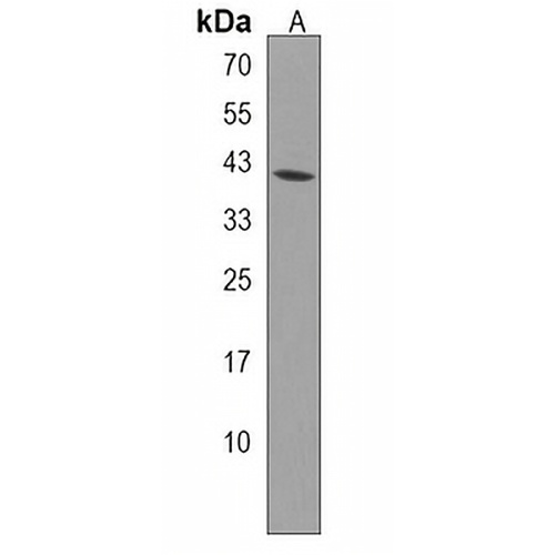 TAS2R31 Rabbit Polyclonal Antibody