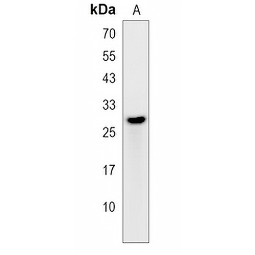 PCTP Rabbit Polyclonal Antibody