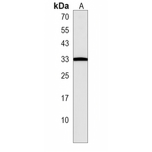 PTPRCAP Rabbit Polyclonal Antibody
