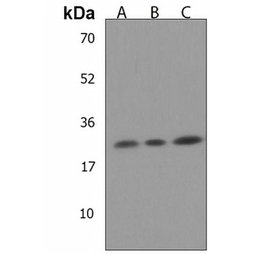 NKAIN2 Rabbit Polyclonal Antibody