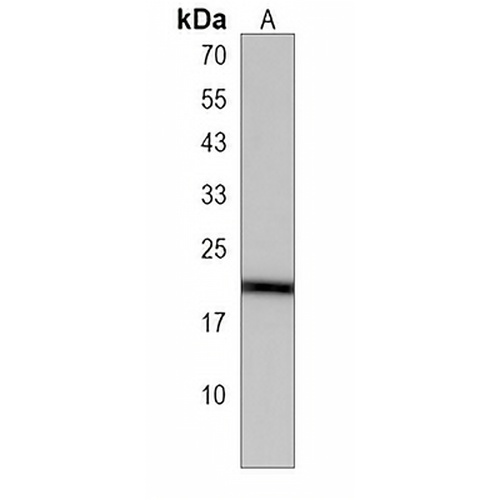 PAIP2 Rabbit Polyclonal Antibody